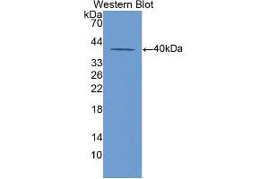 Image no. 3 for anti-Keratin 20 (KRT20) (AA 75-382) antibody (ABIN5013827)