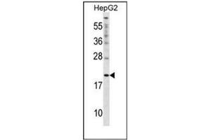 Image no. 1 for anti-Cytoglobin (CYGB) (AA 1-30), (N-Term) antibody (ABIN951802)