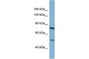 Image no. 1 for anti-UDP-N-Acetyl-alpha-D-Galactosamine:polypeptide N-Acetylgalactosaminyltransferase 5 (GalNAc-T5) (GALNT5) (C-Term) antibody (ABIN2782818)
