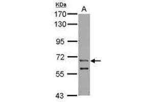 Image no. 1 for anti-Zinc Finger Protein, Y-Linked (ZFY) (AA 431-730) antibody (ABIN1501819)