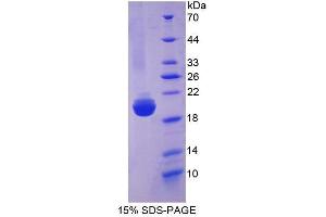 Image no. 1 for Slit Homolog 2 (Drosophila) (SLIT2) (AA 1160-1333) protein (His tag) (ABIN1171383)