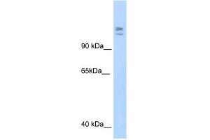 Image no. 2 for anti-Myb-Binding Protein 1A (MYBBP1A) (C-Term) antibody (ABIN2780004)