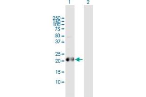 Image no. 1 for anti-BCL2-Like 10 (Apoptosis Facilitator) (BCL2L10) (AA 1-204) antibody (ABIN523396)