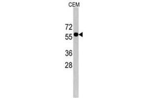 Image no. 1 for anti-CCR4-NOT Transcription Complex Subunit 4 (CNOT4) (C-Term) antibody (ABIN356969)