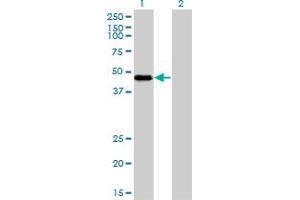 Image no. 4 for anti-RNA Binding Motif Protein 9 (RBM9) (AA 1-100) antibody (ABIN565111)