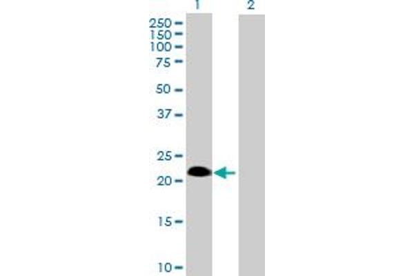 SSPN Antikörper  (AA 1-243)