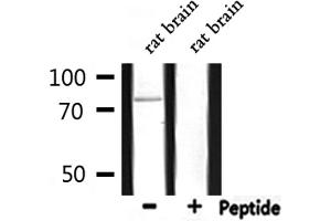 Image no. 1 for anti-Protein Kinase C, gamma (PRKCG) (pThr514) antibody (ABIN6271860)
