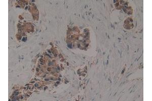 Image no. 3 for anti-Keratin 16 (KRT16) (AA 117-419) antibody (ABIN1172993)
