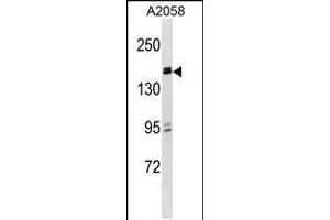 Image no. 1 for anti-Zinc Finger and BTB Domain Containing 38 (ZBTB38) (AA 133-161), (N-Term) antibody (ABIN5532388)