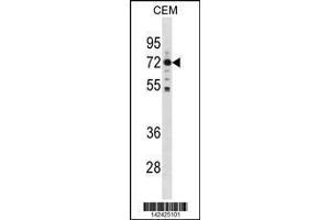Image no. 1 for anti-Male Germ Cell-Associated Kinase (MAK) (AA 595-623), (C-Term) antibody (ABIN1881520)