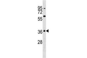 Image no. 1 for anti-Mitogen-Activated Protein Kinase 11 (MAPK11) (AA 334-359) antibody (ABIN3031829)