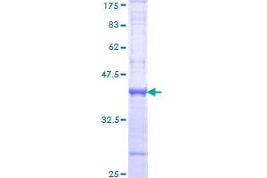 Image no. 1 for Bone Morphogenetic Protein 1 (BMP1) (AA 747-845) protein (GST tag) (ABIN1346744)