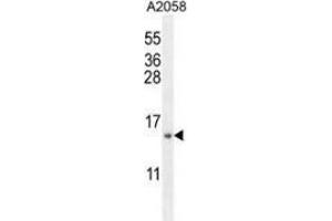 Image no. 3 for anti-Mitochondrial Ribosomal Protein S24 (MRPS24) (AA 28-58), (Middle Region) antibody (ABIN953519)