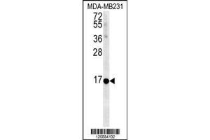 Image no. 1 for anti-Neuromedin B (AA 15-42) antibody (ABIN651541)