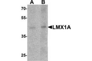 Image no. 1 for anti-LIM Homeobox Transcription Factor 1, alpha (LMX1A) (C-Term) antibody (ABIN1450032)