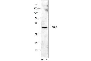 Image no. 3 for anti-Potassium Channel, Subfamily K, Member 3 (KCNK3) (AA 181-280) antibody (ABIN682333)