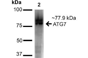 Image no. 2 for anti-ATG7 Autophagy Related 7 (ATG7) (N-Term) antibody (HRP) (ABIN5065898)