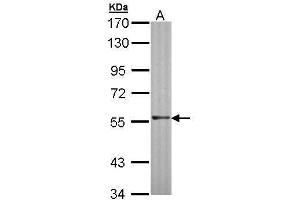 Image no. 3 for anti-Recombination Activating Gene 2 (RAG2) (Center) antibody (ABIN2856698)