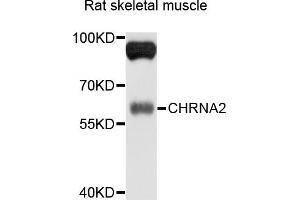 Image no. 2 for anti-Cholinergic Receptor, Nicotinic, alpha 2 (Neuronal) (CHRNA2) antibody (ABIN4903282)