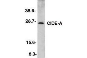 Image no. 1 for anti-Cell Death-Inducing DFFA-Like Effector A (CIDEA) (AA 200-214) antibody (ABIN2472992)