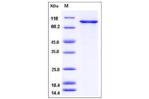 Image no. 1 for Checkpoint Kinase 2 (CHEK2) (AA 1-546) protein (GST tag,His tag) (ABIN2007792)