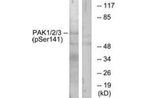 Western blot analysis of extracts from mouse brain, using PAK1/2/3 (Phospho-Ser144/141/139) Antibody.