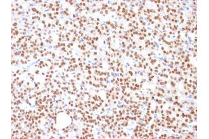 Image no. 4 for anti-Paired Box 8 (PAX8) (AA 60-261) antibody (ABIN6940924)
