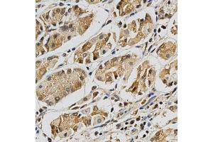 Immunohistochemistry of paraffin-embedded human stomach using LGALS3 antibody at dilution of 1:200 (x400 lens)