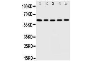 Image no. 2 for anti-Iduronate 2-Sulfatase (IDS) (AA 430-448), (C-Term) antibody (ABIN3042998)