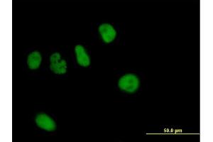 Immunofluorescence of purified MaxPab antibody to ZNF484 on HeLa cell.