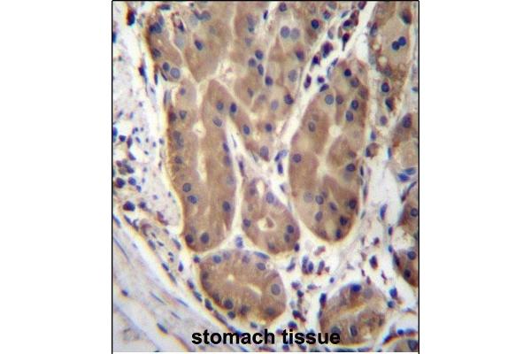 ABHD2 anticorps  (AA 263-292)