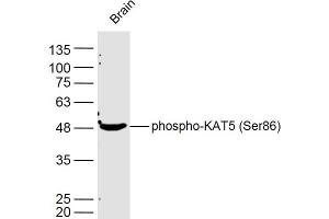 Image no. 1 for anti-K(lysine) Acetyltransferase 5 (KAT5) (pSer86) antibody (ABIN5675404)