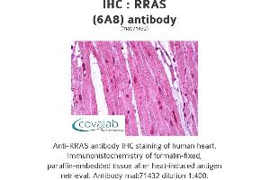 Image no. 1 for anti-R-Ras antibody (ABIN1724486)