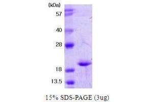 Superoxide Dismutase 1, Soluble (SOD1) (AA 1-154) (Active) protein
