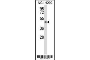 Western Blotting (WB) image for anti-NAD Kinase 2, Mitochondrial (NADK2) (Center) antibody (ABIN2159660)