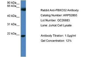 Image no. 2 for anti-F-Box Protein 32 (FBXO32) (N-Term) antibody (ABIN2785130)
