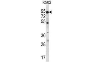 Image no. 2 for anti-ATP-Binding Cassette, Sub-Family D (ALD), Member 2 (Abcd2) (AA 552-582), (C-Term) antibody (ABIN950203)