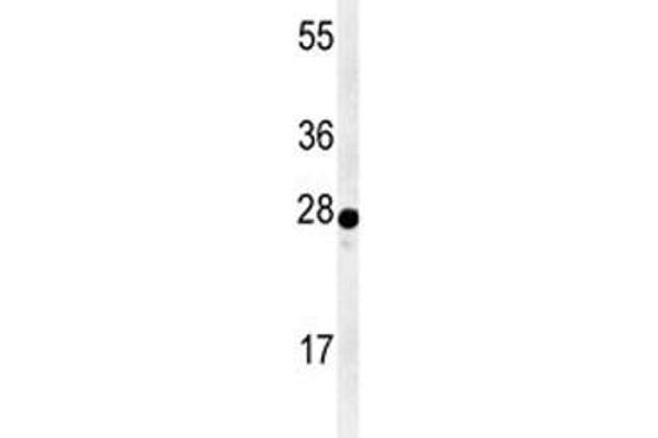 anti-Aralkylamine N-Acetyltransferase (AANAT) (AA 27-54) antibody