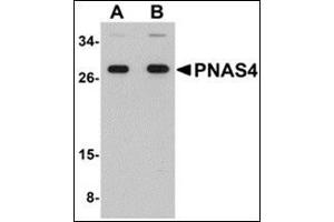 PPPDE1 抗体  (C-Term)