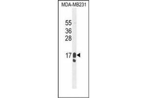 Image no. 3 for anti-Prolactin-Induced Protein (PIP) (AA 84-113), (C-Term) antibody (ABIN952476)