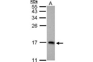 Image no. 1 for anti-6-Pyruvoyltetrahydropterin Synthase (PTS) (full length) antibody (ABIN2856764)