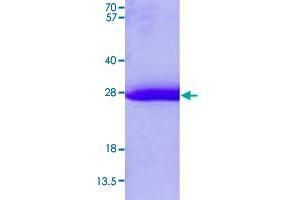 Image no. 1 for FtsJ RNA Methyltransferase Homolog 2 (FTSJ2) (AA 51-246) protein (His tag) (ABIN5569487)