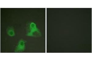 Immunofluorescence analysis of HeLa cells, using ADD1 (Phospho-Ser726) Antibody.