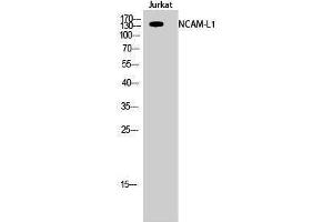Image no. 1 for anti-L1 Cell Adhesion Molecule (L1CAM) (Ser727) antibody (ABIN3185776)