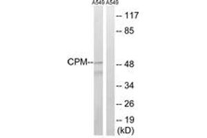 Image no. 1 for anti-Carboxypeptidase M (CPM) (AA 71-120) antibody (ABIN1534735)