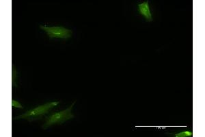 Immunofluorescence of monoclonal antibody to CAMKK1 on HeLa cell.