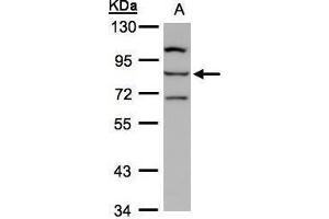 anti-Arachidonate Lipoxygenase 3 (ALOXE3) (Center) antibody