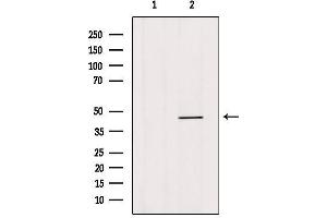 Image no. 1 for anti-Homeobox B3 (HOXB3) (C-Term) antibody (ABIN6262343)