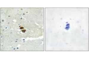 Immunohistochemistry analysis of paraffin-embedded human brain, using n-NOS (Phospho-Ser852) Antibody.