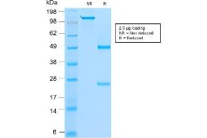 Image no. 1 for anti-Myogenic Differentiation 1 (MYOD1) antibody (ABIN6940160)